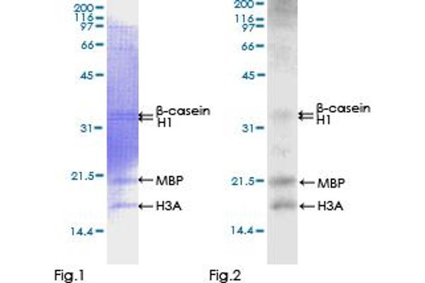 CAMKII gamma Protein (AA 1-527) (GST tag)