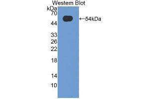 Western blot analysis of the recombinant protein. (Oncostatin M antibody  (AA 26-220))