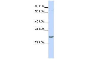 WB Suggested Anti-PRDM5 Antibody Titration:  0. (PRDM5 antibody  (Middle Region))