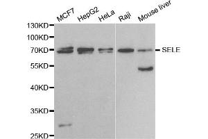 Western blot analysis of extracts of various cell lines, using SELE antibody. (Selectin E/CD62e antibody)