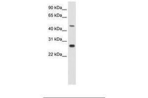 Image no. 1 for anti-Spermatogenic Leucine Zipper 1 (SPZ1) (C-Term) antibody (ABIN202383) (SPZ1 antibody  (C-Term))