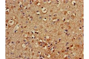 Immunohistochemistry of paraffin-embedded human brain tissue using ABIN7174052 at dilution of 1:100 (TYRO3 antibody  (AA 728-873))