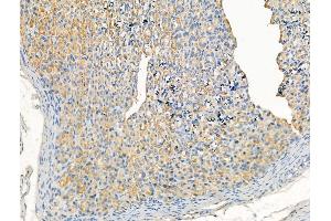 ABIN7094483 and ABIN7098532 at 1/100 staining Rat brain tissue by IHC-P.