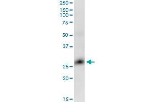 GLIPR1 monoclonal antibody (M04), clone 8D9. (GLIPR1 antibody  (AA 23-99))