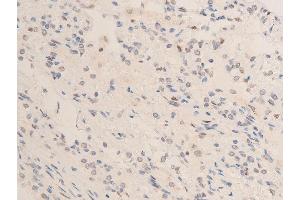ABIN6267253 at 1/100 staining human TB tissue sections by IHC-P. (CHEK2 antibody  (pThr68))