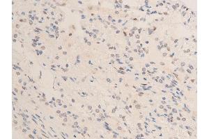ABIN6267253 at 1/100 staining human TB tissue sections by IHC-P.