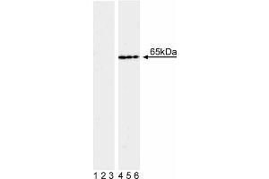 Western blot analysis of NF-kappaB p65 (pS536) in transformed human epithelioid carcinoma.