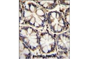 Immunohistochemistry (Paraffin-embedded Sections) (IHC (p)) image for anti-Tumor Necrosis Factor Receptor Superfamily, Member 1A (TNFRSF1A) (AA 17-43), (N-Term) antibody (ABIN655208)