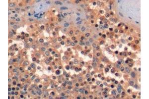 Detection of CD34 in Human Tonsil Tissue using Polyclonal Antibody to Cluster Of Differentiation 34 (CD34) (CD34 antibody  (AA 32-290))