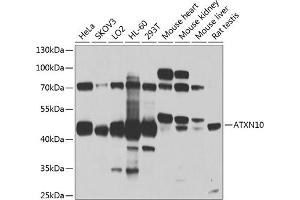 Western blot analysis of extracts of various cell lines, using  antibody (ABIN1678800, ABIN3019073, ABIN3019074 and ABIN6220701) at 1:1000 dilution.