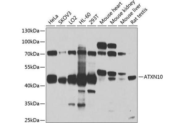 Ataxin 10 抗体  (AA 346-475)