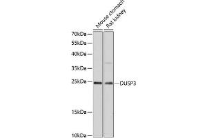 Western blot analysis of extracts of various cell lines, using DUSP3 antibody (ABIN6127792, ABIN6139873, ABIN6139874 and ABIN6215639) at 1:3000 dilution. (Dual Specificity Phosphatase 3 (DUSP3) (AA 1-185) antibody)