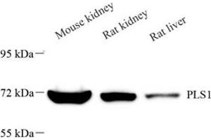 Western blot analysis of PLS1 (ABIN7075096),at dilution of 1: 2000 (PLS1 antibody)