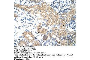 Rabbit Anti-NXF5 Antibody  Paraffin Embedded Tissue: Human Kidney Cellular Data: Epithelial cells of renal tubule Antibody Concentration: 4. (NXF5 antibody  (Middle Region))
