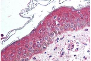 Anti-WNT10B antibody  ABIN1049469 IHC staining of human skin. (WNT10B antibody  (Internal Region))