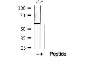 Western blot analysis of extracts of Y79 cells, using KIF12 antibody. (KIF12 antibody  (N-Term))