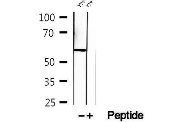 KIF12 antibody  (N-Term)