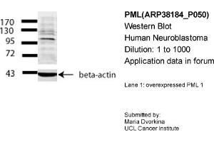 Western Blotting (WB) image for anti-Promyelocytic Leukemia (PML) (Middle Region) antibody (ABIN501870) (PML antibody  (Middle Region))