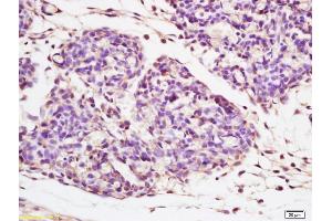 Formalin-fixed and paraffin embedded mouse embryo tissue labeled with Anti-Beta galactosidase Polyclonal Antibody, Unconjugated (ABIN1386129) at 1:200 followed by conjugation to the secondary antibody and DAB staining (GLB1 antibody  (AA 301-380))