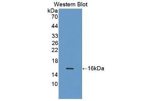 Western Blotting (WB) image for anti-Complement Factor B (CFB) (AA 32-157) antibody (ABIN1175360) (Complement Factor B antibody  (AA 32-157))