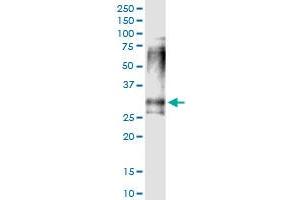 Immunoprecipitation of CLTB transfected lysate using anti-CLTB MaxPab rabbit polyclonal antibody and Protein A Magnetic Bead , and immunoblotted with CLTB purified MaxPab mouse polyclonal antibody (B01P) . (CLTB antibody  (AA 1-211))