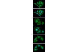 ICC/IF analysis of AK1 in HeLa cell line, stained with DAPI (Blue) for nucleus staining and monoclonal anti-human AK1 antibody (1:100) with goat anti-mouse IgG-Alexa fluor 488 conjugate (Green). (Adenylate Kinase 1 antibody  (AA 1-194))