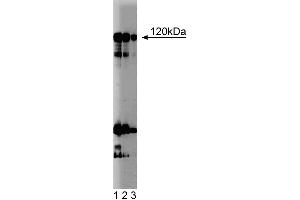 Western blot analysis of NFAT-1 on a Jurkat cell lysate (Human T-cell leukemia, ATCC TIB-152). (NFAT1 antibody  (AA 29-181))