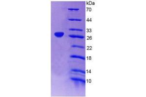 SDS-PAGE (SDS) image for beta-Carotene 15,15'-Monooxygenase 1 (BCMO1) (AA 6-206) protein (His tag) (ABIN6237337) (BCMO1 Protein (AA 6-206) (His tag))