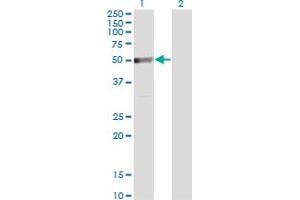 Western Blot analysis of TRIP6 expression in transfected 293T cell line by TRIP6 monoclonal antibody (M07), clone 3D12.