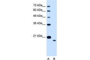 Western Blotting (WB) image for anti-Transmembrane Protein 91 (TMEM91) antibody (ABIN2463997) (TMEM91 antibody)