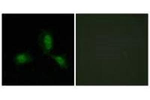 Immunofluorescence analysis of HeLa cells, using IRS-1 (Ab-312) antibody. (IRS1 antibody  (Ser312))