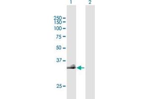 Western Blot analysis of HAS3 expression in transfected 293T cell line by HAS3 MaxPab polyclonal antibody. (HAS3 antibody  (AA 1-281))