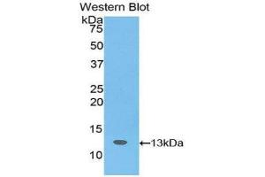 Western Blotting (WB) image for anti-Slit Homolog 3 (SLIT3) (AA 62-119) antibody (ABIN1176113) (SLIT3 antibody  (AA 62-119))