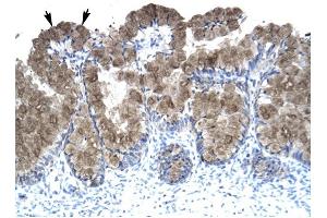 ASGR2 antibody was used for immunohistochemistry at a concentration of 4-8 ug/ml to stain Epithelial cells of intestinal villus (arrows) in Human Intestine.