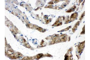 Cardiac FABP was detected in paraffin-embedded sections of rat cardiac muscle tissues using rabbit anti- Cardiac FABP Antigen Affinity purified polyclonal antibody (Catalog # ) at 1 µg/mL.
