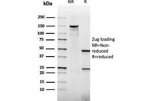 SDS-PAGE Analysis Purified Thrombomodulin Mouse Recombinant Monoclonal Antibody (rTHBD/1591). (Recombinant Thrombomodulin antibody  (AA 69-194))