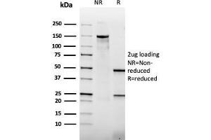 SDS-PAGE Analysis Purified Thrombomodulin Mouse Recombinant Monoclonal Antibody (rTHBD/1591).