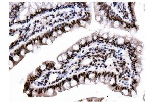 IHC analysis of Hexokinase 1/HK1 using anti-Hexokinase 1/HK1 antibody (ABIN7602561).