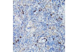 Immunohistochemistry of paraffin-embedded rat spleen using DDIT3/CHOP Rabbit pAb (ABIN6131562, ABIN6139460, ABIN6139463 and ABIN6215170) at dilution of 1:200 (40x lens). (DDIT3 antibody  (AA 1-169))