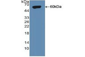 Detection of Recombinant SORT1, Human using Polyclonal Antibody to Sortilin 1 (SORT1) (Sortilin 1 antibody  (AA 50-320))