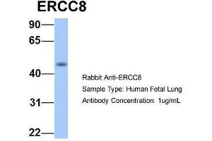 Host:  Rabbit  Target Name:  ERCC8  Sample Type:  Human Fetal Lung  Antibody Dilution:  1. (ERCC8 antibody  (C-Term))