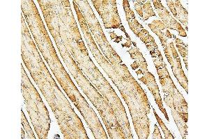 IHC analysis of Desmin using anti-Desmin antibody (ABIN7599249).