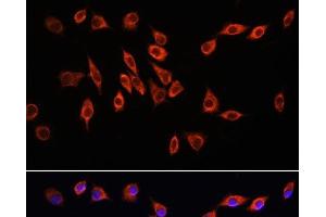 Immunofluorescence analysis of L929 cells using NRP1 Polyclonal Antibody at dilution of 1:100. (Neuropilin 1 antibody)