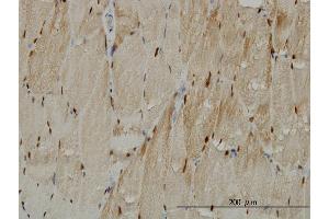 Immunoperoxidase of monoclonal antibody to TTN on formalin-fixed paraffin-embedded human skeletal muscle. (Titin antibody  (AA 1-110))
