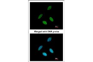 Immunofluorescence analysis of paraformaldehyde-fixed HeLa, using TAP antibody at 1:200 dilution. (NXF1 antibody)