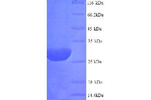 SDS-PAGE (SDS) image for Deiodinase, Iodothyronine, Type II (DIO2) (AA 1-266), (full length) protein (His tag) (ABIN5713964)