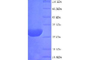SDS-PAGE (SDS) image for Deiodinase, Iodothyronine, Type II (DIO2) (AA 1-266), (full length) protein (His tag) (ABIN5713964) (DIO2 Protein (AA 1-266, full length) (His tag))