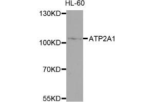Western blot analysis of extracts of HL-60 cells, using ATP2A1 antibody (ABIN4902981) at 1:1000 dilution. (ATP2A1/SERCA1 antibody)