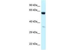 Image no. 1 for anti-Prolyl 4-Hydroxylase, alpha Polypeptide I (P4HA1) (AA 228-277) antibody (ABIN6747682) (P4HA1 antibody  (AA 228-277))