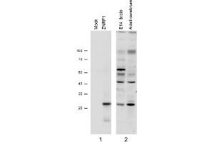 N2a overexpressing Mouse Znrf1 (mock transfection in first lane) and probed with ZNRF1 Antibody   (1µg/ml), also staining of Mouse Brain lysates (Embryo E14 and adult cerebellum). (ZNRF1 antibody)